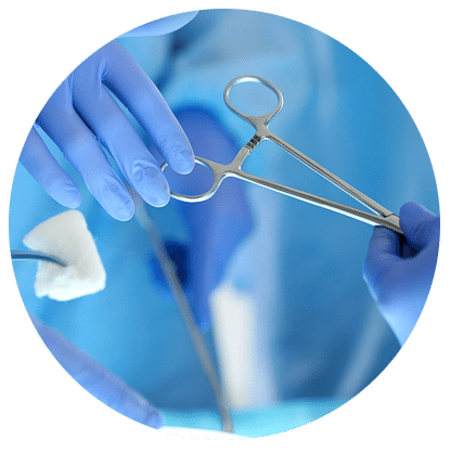 Fertility Surgery